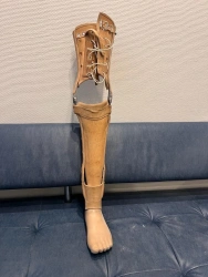Non- Modular Lower Limb Prosthesis for Congenital Underdevelopment