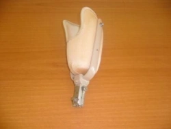 Functional Hand Prosthesis for Partial Hand Amputation