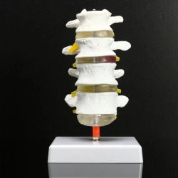 Four Lumbar Vertebra Model, 11109-3