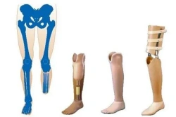 Therapeutic Training Shin Prosthesis for Rehabilitation