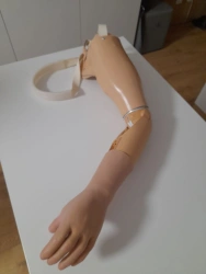 Microprocessor-Controlled Shoulder Prosthesis