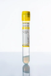 Sterile Vacuum Blood Collection Tubes with Clot Activator and Gel, 16*100 mm