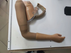 Functional-Cosmetic Prosthesis for Above-Elbow Amputation