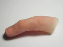 Cosmetic Finger Prosthesis for Aesthetic Restoration
