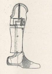 Shopar Foot Prosthesis (Lisfranc) PN0-06-03
