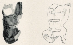 Functional Corrective Corset for Lumbar Spine - Sheno KR4SH