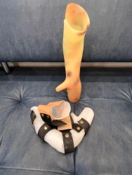 Forearm Brace Adjustable Support for Wrist and Arm Stabilization