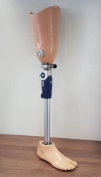 Modular Hip Prosthesis 8-07-10 for Congenital Deficiency