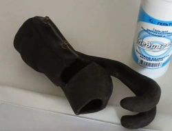 Functional Hand Prosthesis for Partial Hand Amputation