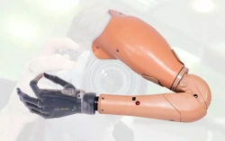 Microprocessor-Controlled Shoulder Prosthesis