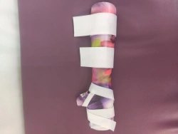 Custom-Made Arm Brace TR8-01 for Medical Rehabilitation