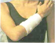 Forearm Brace Adjustable Support for Injury Recovery