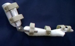 Orthopedic Support Device for Wrist and Elbow Joints