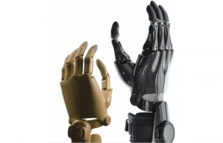 Active Hand Prosthesis for Partial Hand Amputation