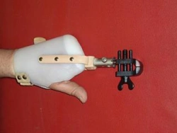 Functional Hand Prosthesis PР0-11 for Partial Hand Amputation