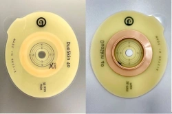 Stoma Rehabilitation Product for Colostomies, Ileostomies, and Urostomies: Flat Plate, Convex Plate