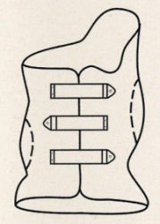 Functional Corrective Corset for Thoracolumbar Spine KР4-20