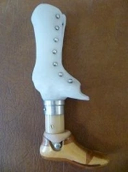 Lower Limb Prosthetics for Congenital Limb Deficiency