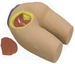 Muscle Injection Training Model for Intramuscular Injections NS6023 / T3