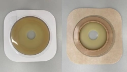 Stoma Rehabilitation Device for Colostomies, Ileostomies, and Urostomies: Flat and Convex Plates