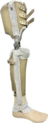 Non-Module Lower Leg Prosthesis PN3-14 for Amputation Recovery