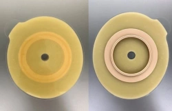 Stoma Rehabilitation Device for Colostomies, Ileostomies, and Urostomies: Flat and Convex Plates