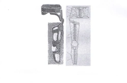 Adjustable Knee and Hip Joint Device ANK-KSTS