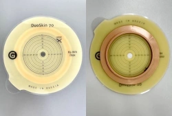 Stoma Rehabilitation Device for Colostomy, Ileostomy, and Urostomy