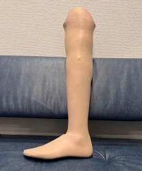 Modular Lower Leg Prosthesis for Congenital Underdevelopment