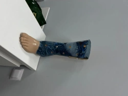 Custom Foot Prosthesis 8-07-01