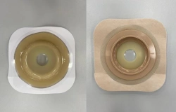 Rehabilitation Product for Stoma Use with Flat and Convex Plates