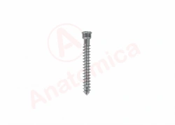 Cortical Screw with Cylindrical Thread for Bone Fractures