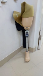 Modular Hip Prosthesis for Congenital Underdevelopment PN6-OB