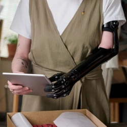 Active Prosthesis Arm