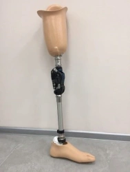 Modular Hip Prosthesis for Amputation Recovery