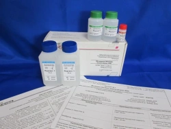 Enzyme Reagent Kit for Urea Concentration Determination in Serum and Plasma