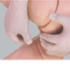 Child Enema Simulation Mannequin for Training S161