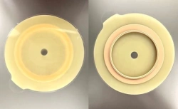 Stoma Rehabilitation Device for Colostomies, Ileostomies, and Urostomies: Flat and Convex Plates