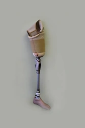 Modular Hip Prosthesis for Congenital Underdevelopment PN6-72