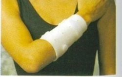 Forearm Brace for Stabilization and Support