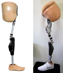 Modular Prosthesis