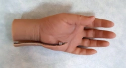 Cosmetic Hand Prosthesis for Partial Hand Amputation