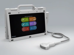 SmartScan 15A Portable Ultrasonic Diagnostic Scanner