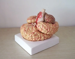 Human Brain Model with Vessels (6 Parts) - Art. 18220-2