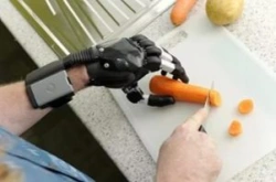 Microprocessor-Controlled Hand Prosthesis for Partial Hand Amputation