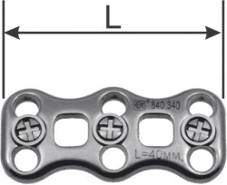 Bone Plates & Screws