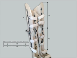 Custom Full Leg Orthosis with Metal Frame