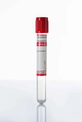 Vacuum Blood Collection Tubes, Glass, 16*100 mm, 10 ml - KORVEY