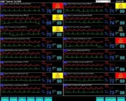 Triton Centralized Monitoring System SCM for Patient Monitoring