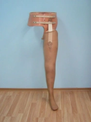 Modular Prosthesis for Hip Disarticulation